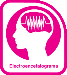 ELECTROENCEFALOGRAMA